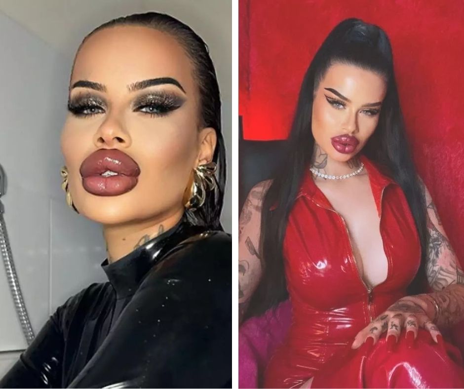 Woman on journey to be her ‘best plastic self’ shares image of what she looked like before $48K lip fillers and body modifications